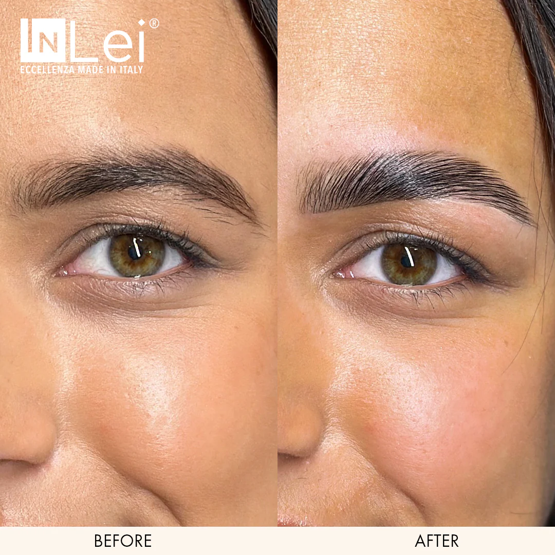 InLei® "Brow Lift 1" - Image 4